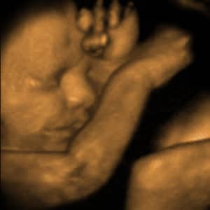 how much does a 3d sonogram cost