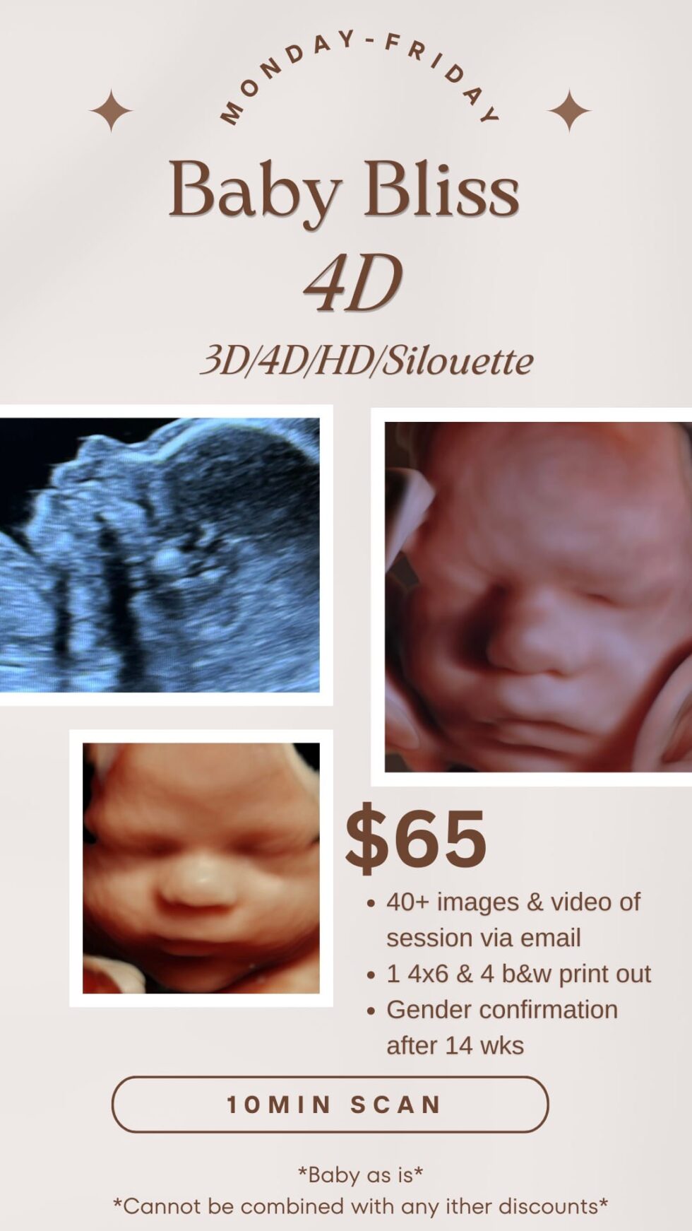 Ultrasound Packages | 3D 4D HD Ultrasound | Ultrasound Near Me | Baby ...
