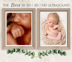 3D Sonography Near me